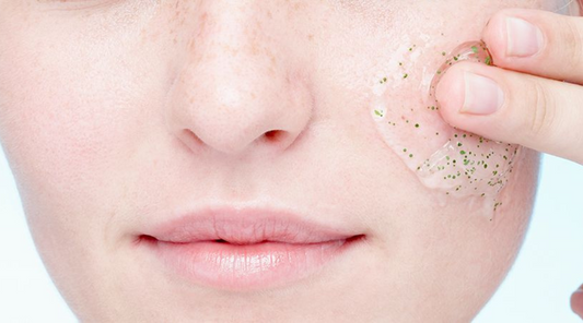 Causes and Types of Acne Scars, and How to Treat Them Effectively